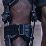 Gasolina, do Cruzeiro, posta mensagem inspiradora após cirurgia no joelho