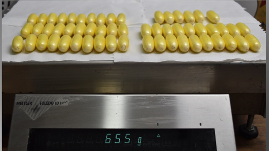 Mulher é presa ao tentar viajar para a França com drogas no estômago | CNN Brasil