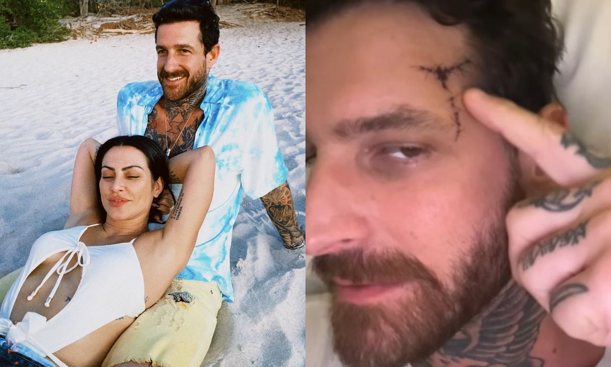 Marido de Cleo Pires recebe alta do hospital após sofrer traumatismo craniano
