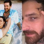 Marido de Cleo Pires recebe alta do hospital após sofrer traumatismo craniano