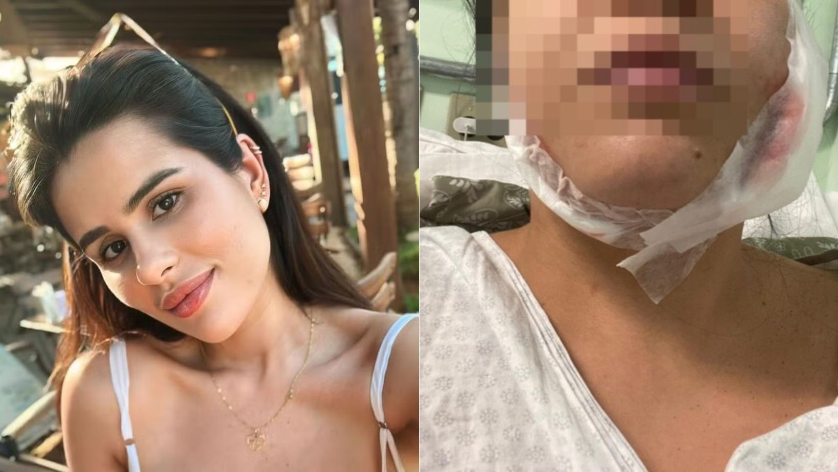 'Lipo de papada': defensoria pede bloqueio de bens de R$ 2,5 milhões de dentista em BH