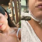 'Lipo de papada': defensoria pede bloqueio de bens de R$ 2,5 milhões de dentista em BH