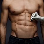 Luciana Pepino | Lipo HD masculina: a escultura corporal que vai além da estética