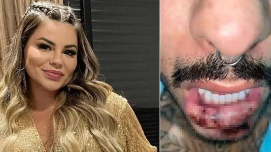Fotos mostram a biomédica Lorena Marcondes e o detalhe da boca do paciente que a processou