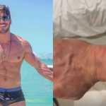Lucas Viana, campeão de 'A Fazenda', mostra hematomas ao revelar grave perrengue em Dubai