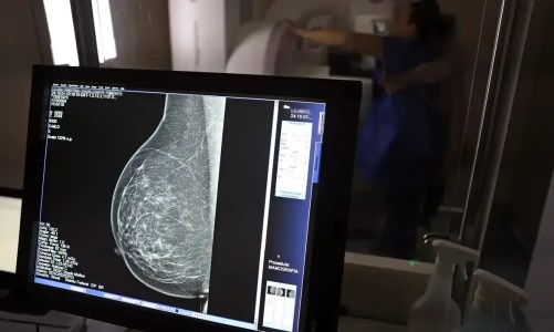 Mamografia será feita de graça na rodoviária de Brasilia durante o mês do outubro rosa