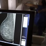 IA pode detectar risco de doenças cardíacas em mulheres pela mamografia, diz estudo