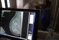 PBH aumenta oferta de mamografias pelo SUS e reduz tempo de espera