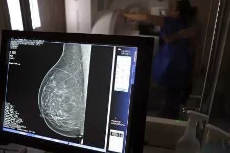 PBH aumenta oferta de mamografias pelo SUS e reduz tempo de espera