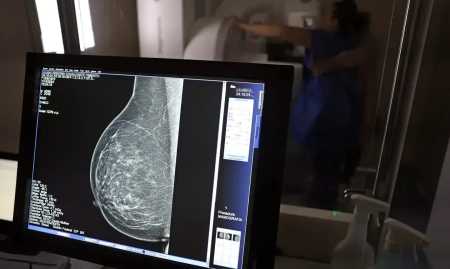 Mamografia será feita de graça na rodoviária de Brasilia durante o mês do outubro rosa