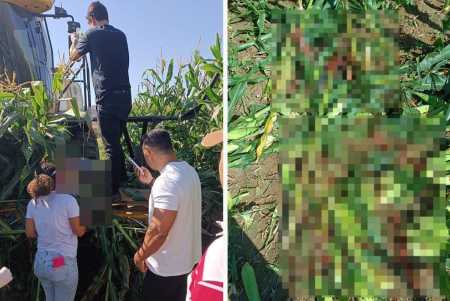 Fotos mostram homem que teve pernas engolidas por máquina de moer milho