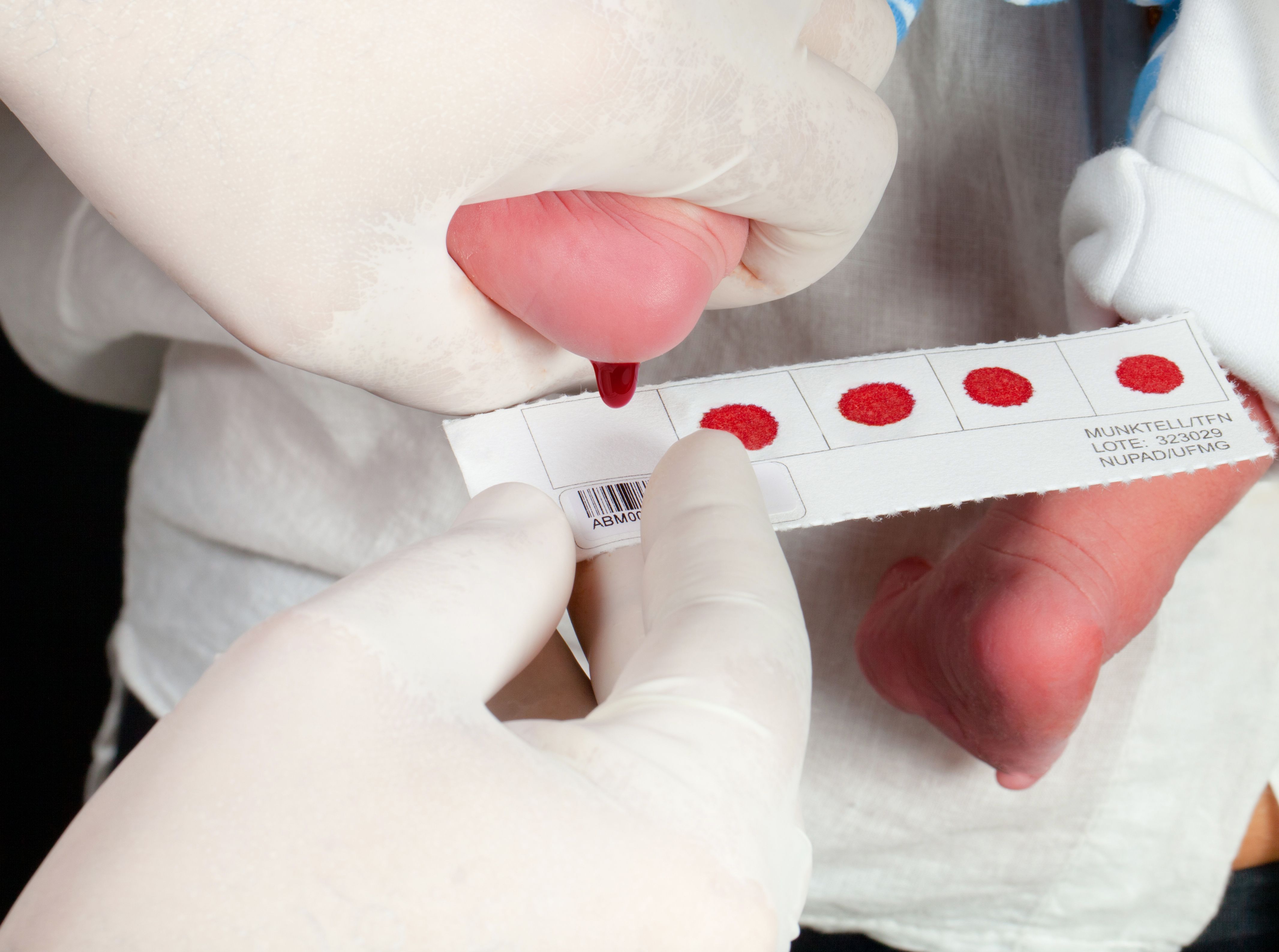 Teste do pezinho: bebês serão diagnosticados para mais três doenças em Minas