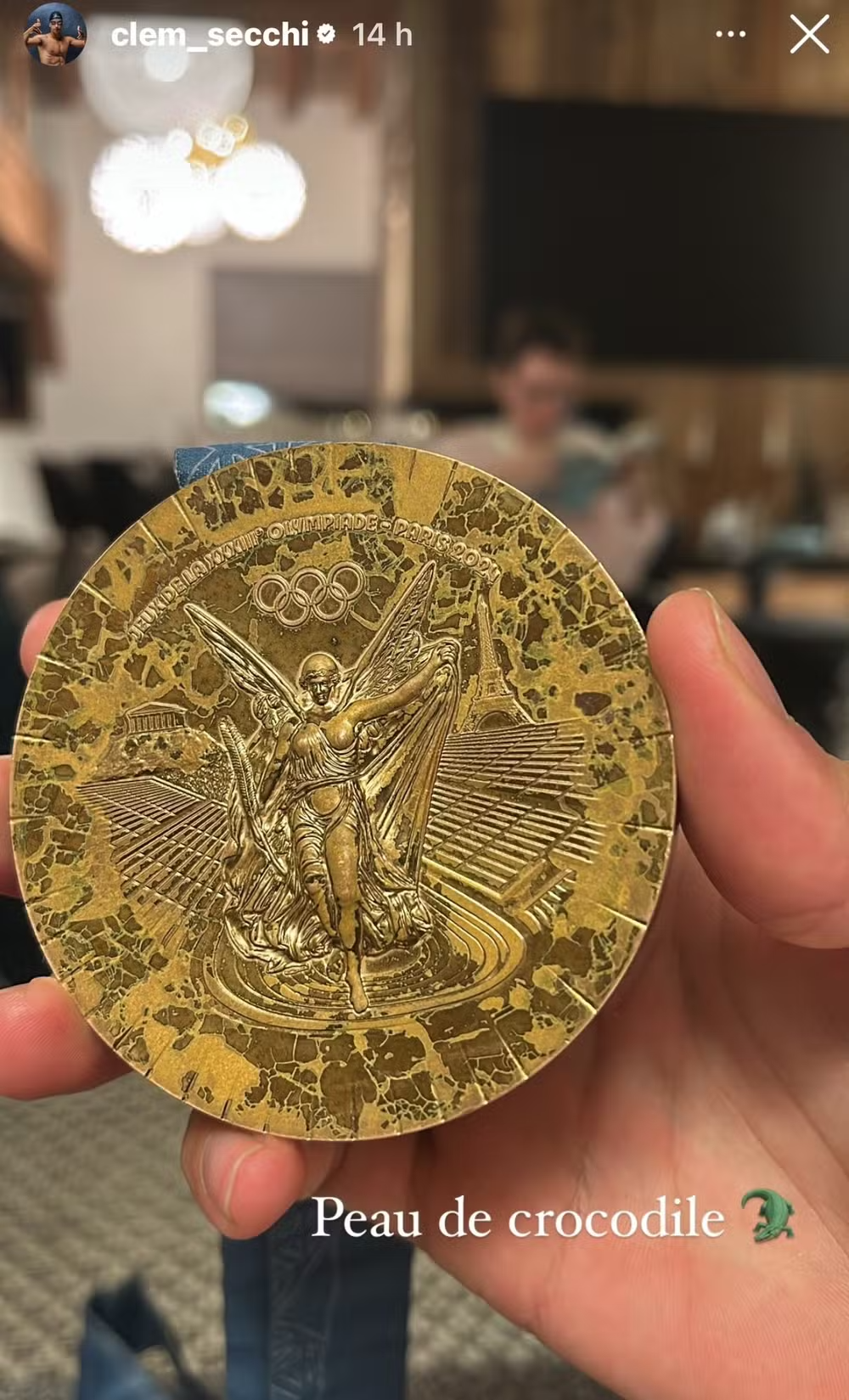 Medalhistas em Paris 2024 zombam de estado das medalhas: 'Pele de crocodilo'