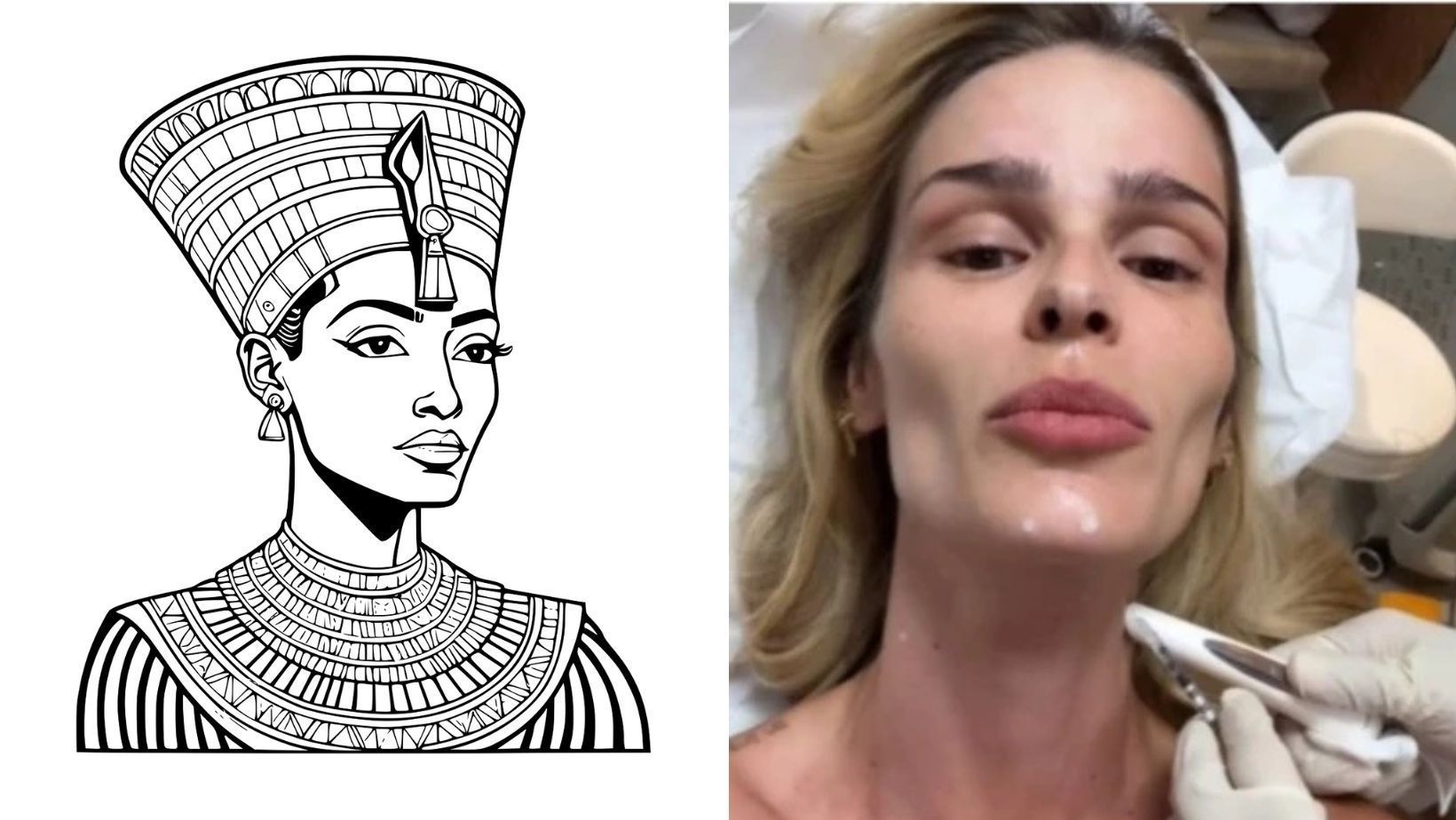 Médica explica como funciona 'botox Nefertiti', procedimento estético inspirado em rainha egípcia
