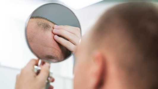 Medicamento aprovado pela Anvisa trata mais do que a calvície