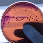 Medicamento reduz capacidade de bactérias de desenvolver resistência a antibióticos