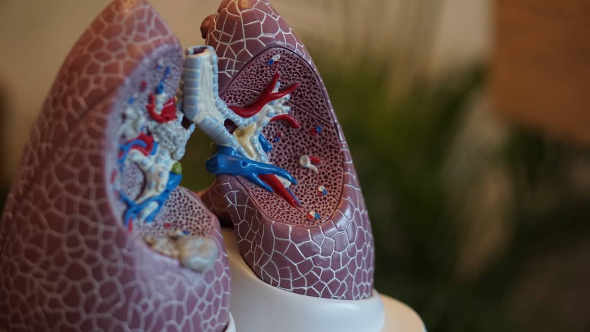 Medicamento contra câncer de pulmão reduz risco de morte em 51%