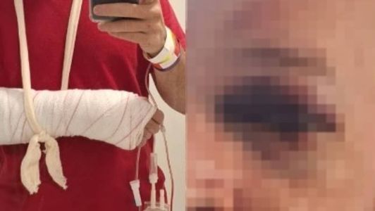 Médico agredido por acompanhante de paciente em Centro de Saúde da Pampulha