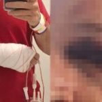 Médico agredido por lutador em centro de saúde: 'Usou artes marciais para tentar me matar '