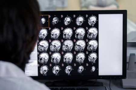 Diagnóstico de esclerose múltipla envolve exames de imagem