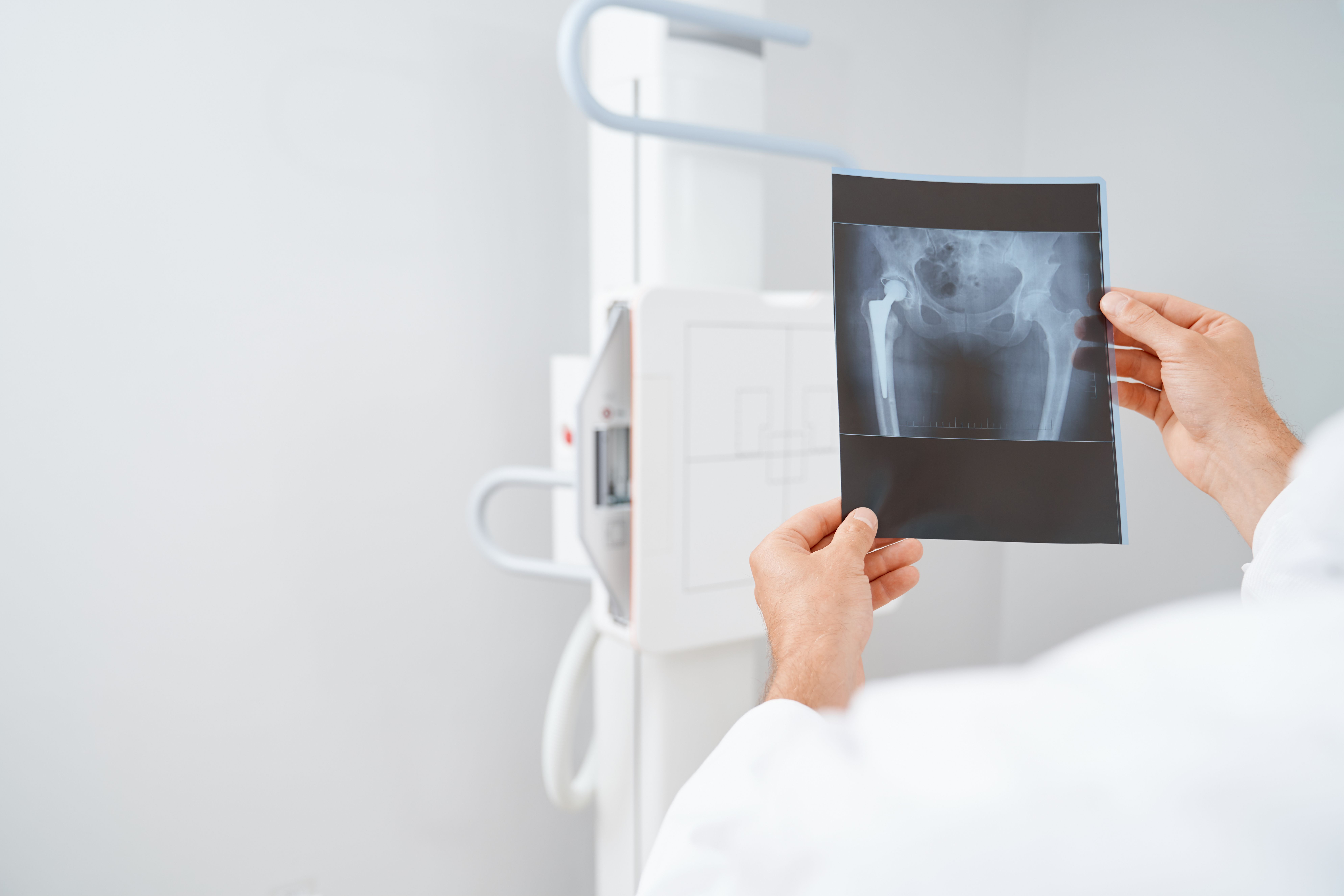 Jovem de 24 anos passa por cirurgia para retirada de cinco celulares do ânus em MG