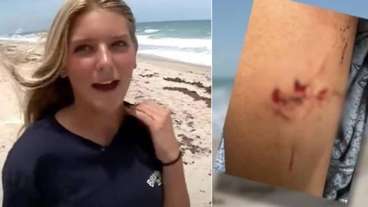 Tubarão que atacou adolescente tinha quase dois metros de comprimento