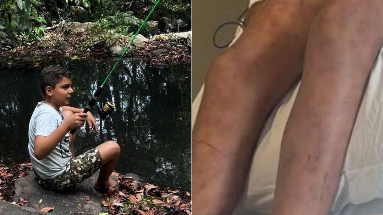 Menino de 9 anos morre após ser atacado por abelhas enquanto brincava perto de área de mata