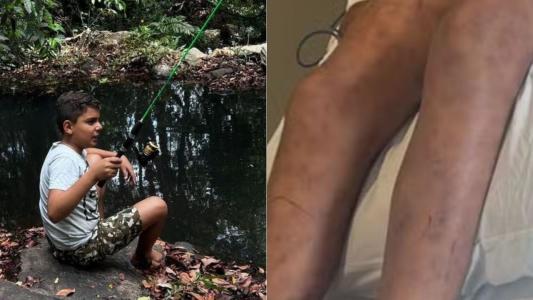 Menino de 9 anos morre após ser atacado por abelhas enquanto brincava perto de área de mata