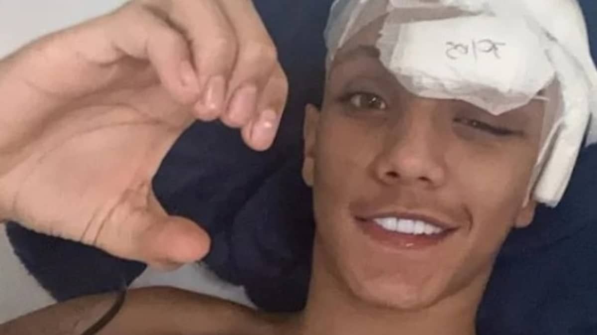 Influenciador leva tiro na cabeça e grava vídeo dançando no hospital