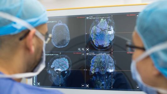 Mesmo casos leves de Covid-19 causam alterações no cérebro, aponta estudo.