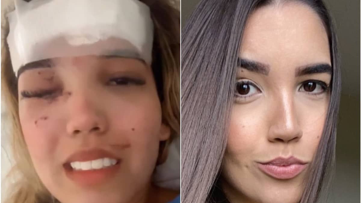 Vídeo: advogada atingida por paralelepípedo chora, agradece a Deus e diz chegou a perder a visão