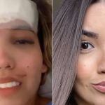 Vídeo: advogada atingida por paralelepípedo chora, agradece a Deus e diz chegou a perder a visão