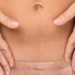 5 piores erros de quem quer fazer uma cirurgia plástica e que você precisa saber!