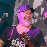 Mingau, do Ultraje, será submetido a cranioplastia; saiba o que é procedimento