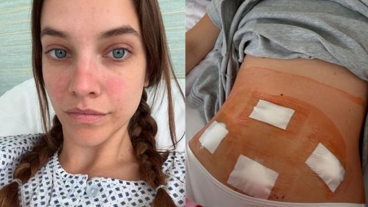 Barbara Palvin passou por cirurgia para combater a doença