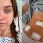 Aos 31 anos, modelo Barbara Palvin detalha diagnóstico de doença incurável: 'Dor intensa'