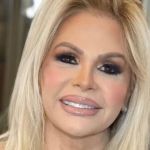 Monique Evans faz harmonização facial; veja antes e depois