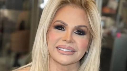 Monique Evans compartilhou resultado de harmonização facial