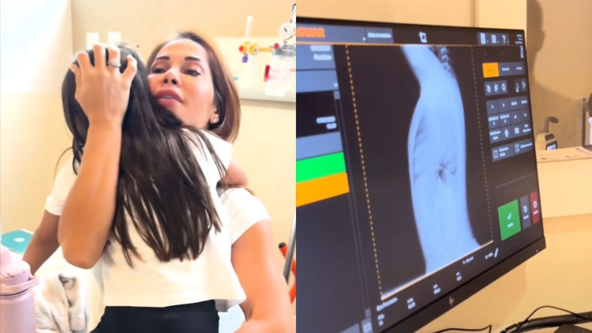 O que é buraco no coração? Filha de Maira Cardi e Arthur Aguiar recebeu diagnóstico