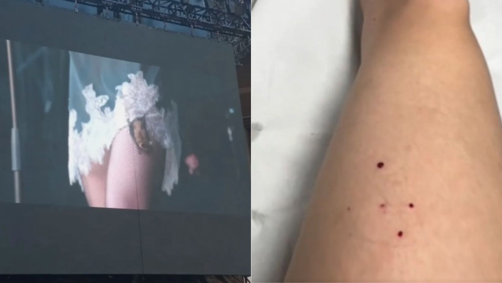 Cantora é mordida por morcego em show e precisa fazer tratamento contra raiva; confira o vídeo