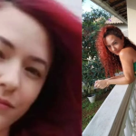 Mulher que morreu durante retirada de DIU teve edema pulmonar, diz laudo