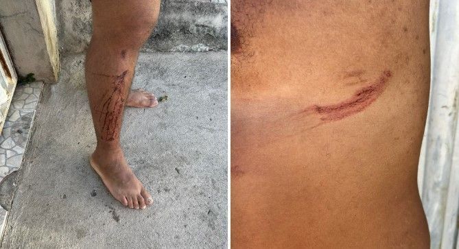 Motoboy vai fazer entrega para ‘Barbie’ em boate de BH, é agredido e atropelado