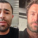 Motorista que atropelou Kayky Brito critica frieza do ator: 'Sinto uma resistência'