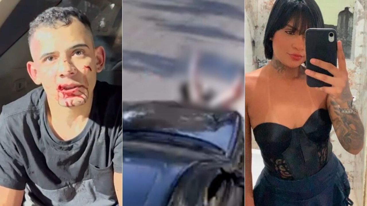 Mulher arrastada na Marginal Tietê terá que passar por nova amputação; mãe desabafa