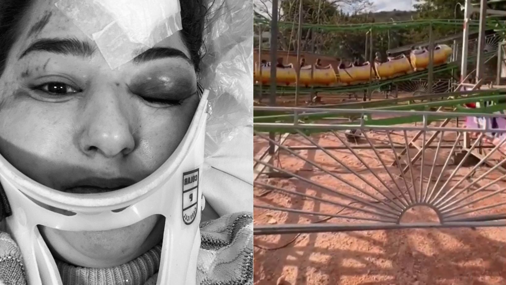 'Estar viva é um milagre', relata mulher arremessada de 'minhocão' em parque de diversões em MG