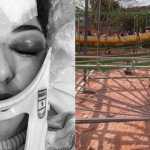 'Estar viva é um milagre', relata mulher arremessada de 'minhocão' em parque de diversões em MG