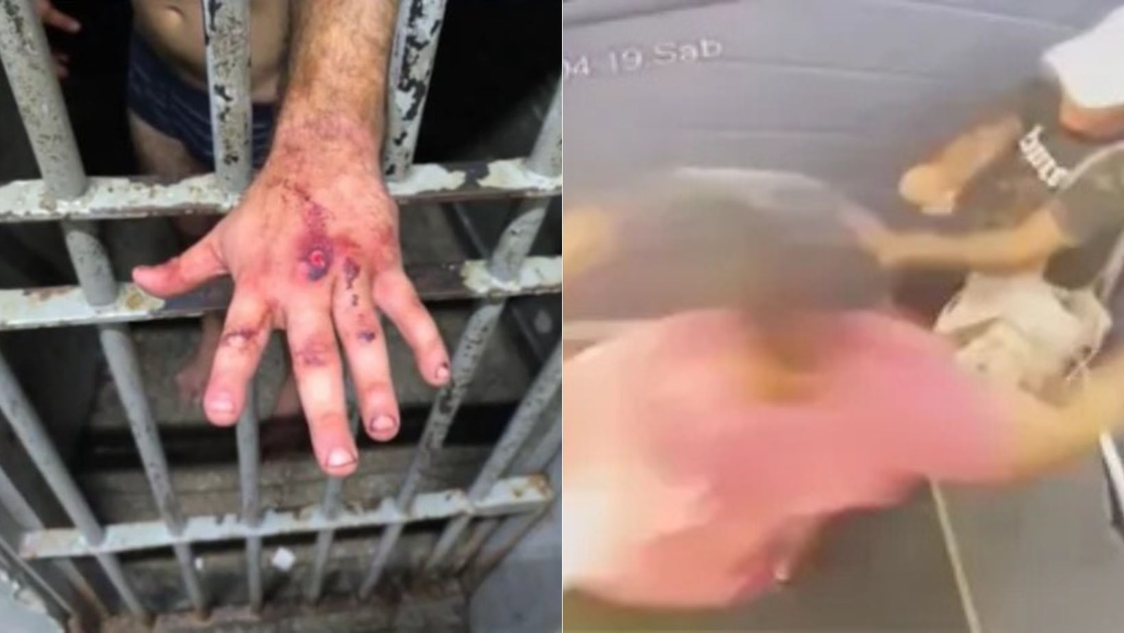 Mulher espancada em elevador sofreu lesões semelhantes às de um acidente de moto sem capacete