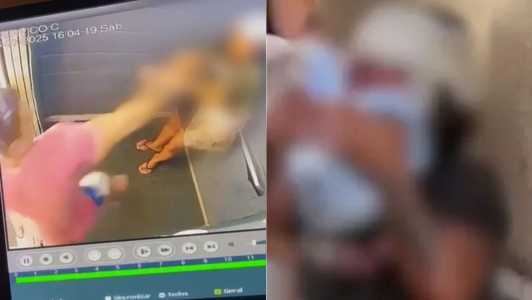 Mulher espancada no elevador será operada nesta sexta e terá que usar miniplacas no rosto