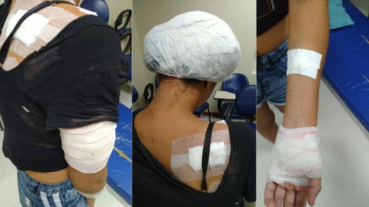 Homem esfaqueia mulher 14 vezes e só para depois da faca quebrar 