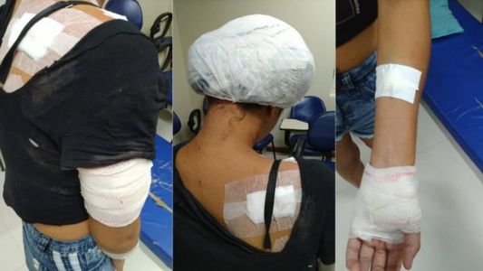 Mulher foi esfaqueada 14 vezes pelo companheiro